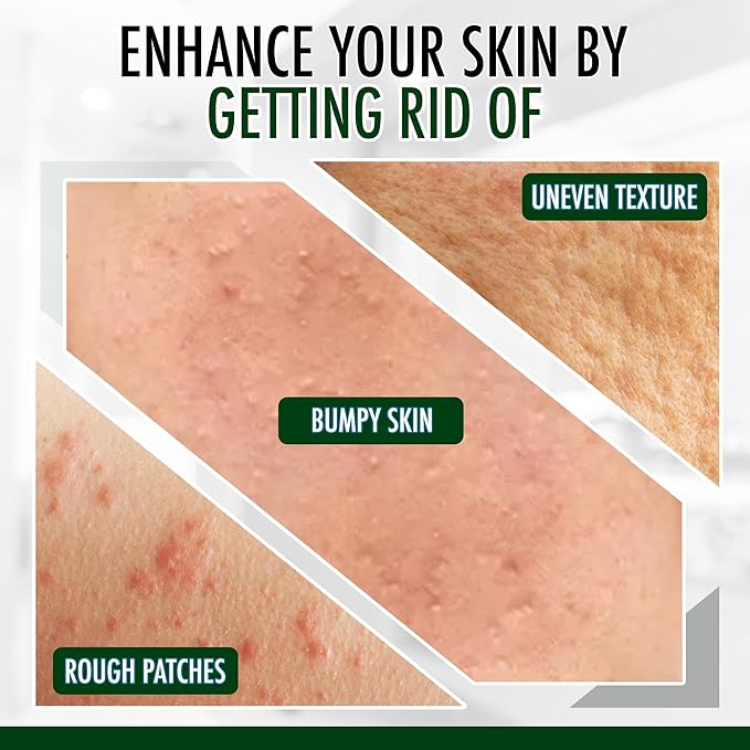 GLY MIRACLE Moisturizing Body Cream Lotion 16 ounce - Non-Greasy Skin Humectant for Extremely Dry Skin Hands Body and Feet Fragrance-Free with Pure Glycerin for Nourishing Hydration.