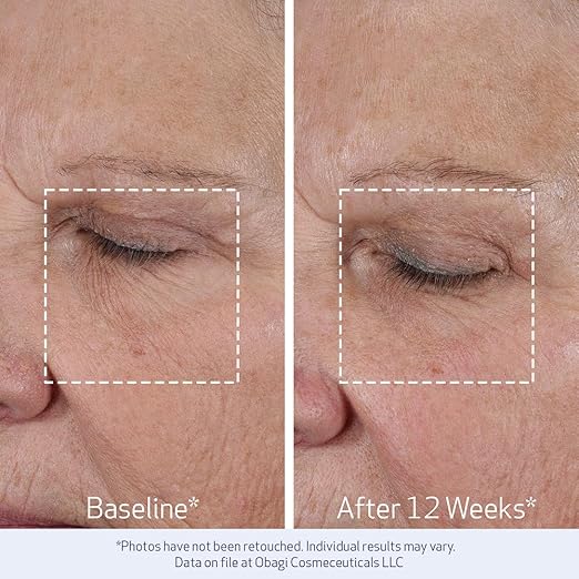 Obagi ELASTIderm Lift Up &amp Sculpt Facial Moisturizer ? Clinically Proven Anti-Aging Face Cream that Visibly Firms &amp Sculpts Facial Contours &amp Reduces Fine Lines &amp Wrinkles with Peptid