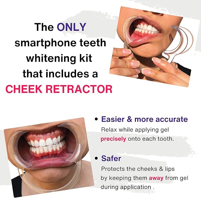 Professional Teeth Whitening Kit LED Accelerator Light 36% Carbamide Peroxide Teeth Whitening Gel 20 Whitening Treatments Remineralizing Gel USA-Made Gels