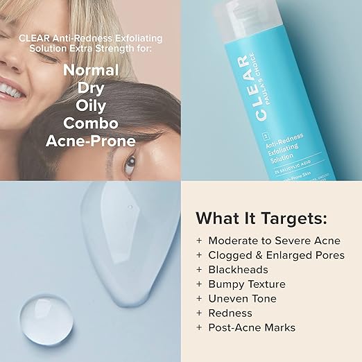 Paula's Choice CLEAR Anti-Redness Exfoliating Solution 2% Salicylic Acid Liquid Exfoliant for Face Face Exfoliant for Mild to Severe Acne &amp Breakouts Blackhead-Prone Skin Fragrance-Free