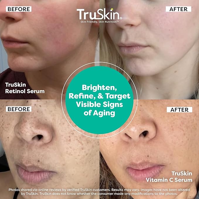 TruSkin Face Serum Duo ? Vitamin C &amp Retinol Serum for Face ? Anti-Aging Skin Care Gift Set for Women ? Helps Improve Appearance of Fine Lines &amp Wrinkles for Smoother Looking Skin 1 Fl Oz 2