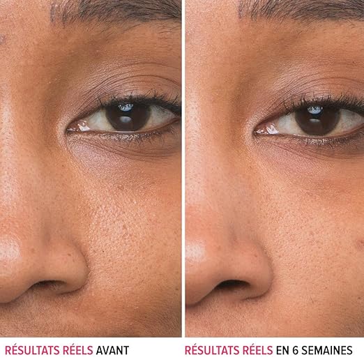 IT Cosmetics Bye Bye Pores 10% Glycolic Acid Face Serum - Visibly Minimizes Pores In 1 Week &amp Gently Exfoliates to Help Refine Skin?™s Texture - With Hyaluronic Acid for Hydration -1 Fl. Oz