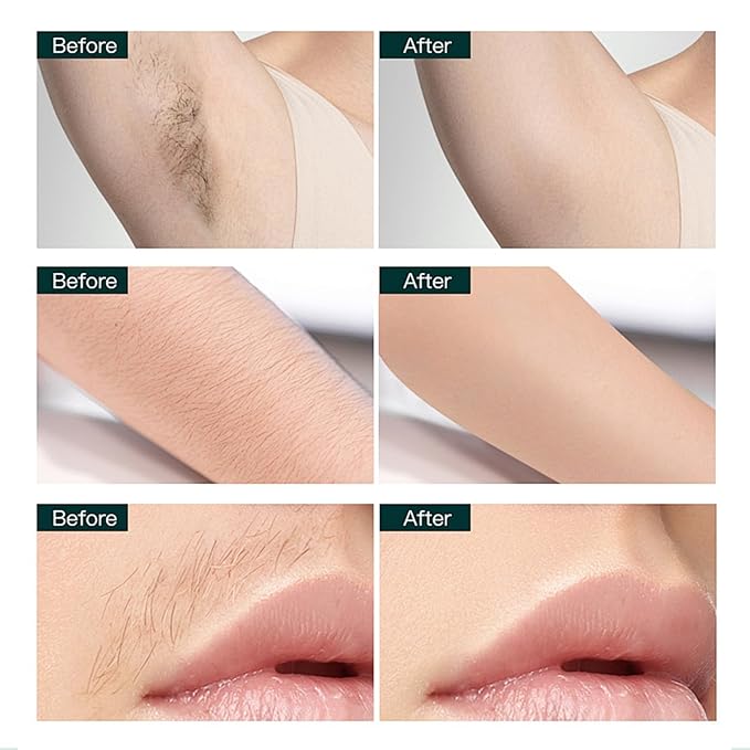 VGO 3 pack Hair Removal Spray Foam Contains Aloe Vera Extract Natural Ingredients Painless Bikini Hair Removal for Women &amp Men Depilatory Cream 15.21FL OZ