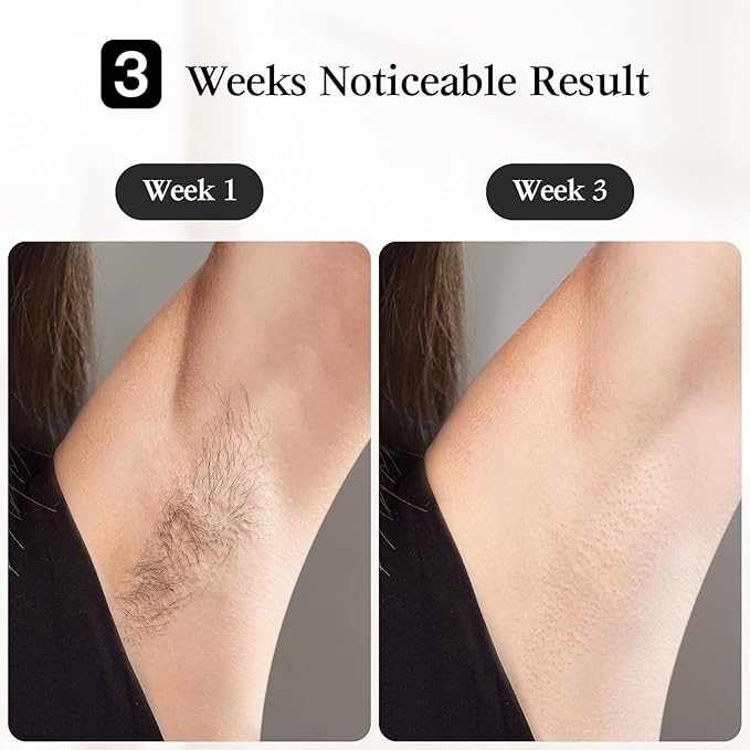 JOVS Laser Hair Removal [24J Energy] IPL Hair Removal for Women and Men 37°F Painless Sapphire Ice-Cooling Tech 6 Modes for Whole Body Hair Removal Device 2 in 1 Skin Rejuvenation 330° Rotation