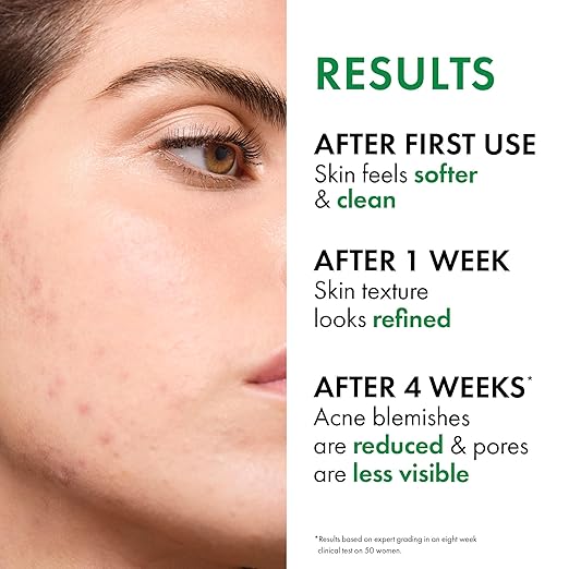 VICHY Normaderm Acne Control Daily Moisturizer Oil Free Acne Moisturizer For Face Max Strength 2% Salicylic Acid + Hyaluronic Acid + Vitamin C Targets Blackheads Blemishes &amp Enlarged Pores
