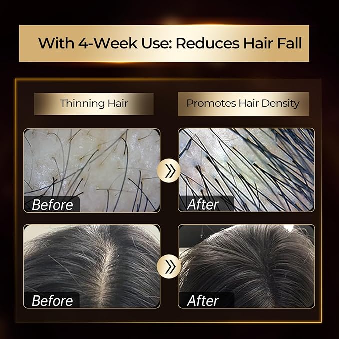 Hair Regrowth Treatments Includes Scalp Massage Cream Shampoo Scalp Serum. Hair Strengthening Black Gold Series Hair Gift Set