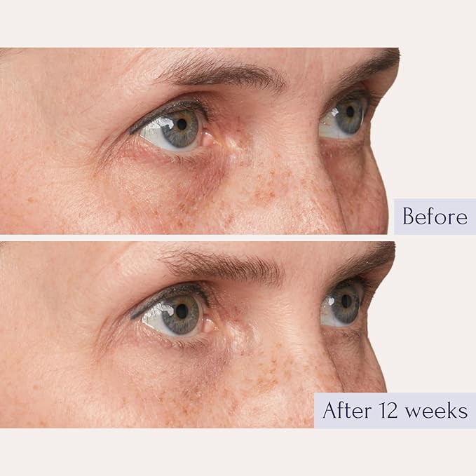 Tru Alchemy Eye Elixir Cooling Eye Treatment Cream - Dark Circle Eye Cream for Puffiness and Bags Under Eyes - Caffeine Hyaluronic Acid Vitamin C