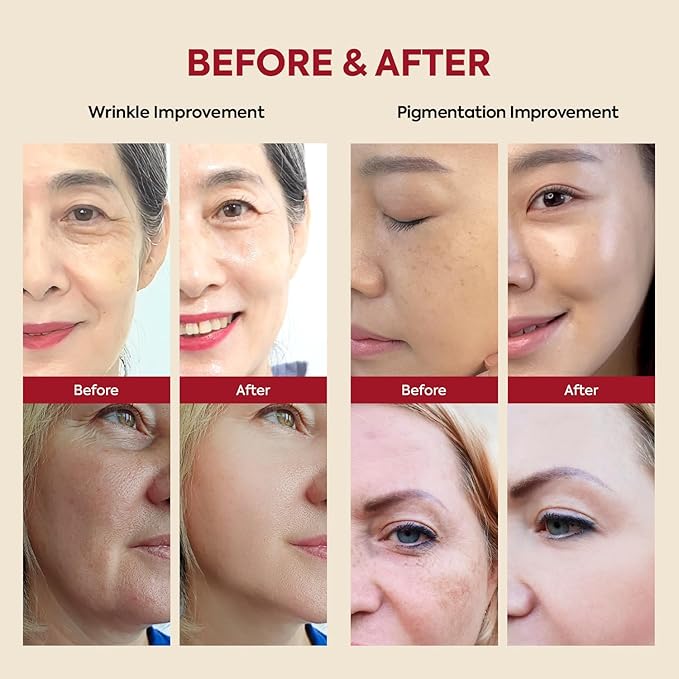 K-SECRET SEOUL 1988 Retinal Serum: Retinol Serum for Face Anti Aging Wrinkle Care - 2% Retinal Liposome Black Ginseng Niacinamide Bakuchiol Vitamin C &amp 3 Peptides - Korean Skincare Fragrance Free