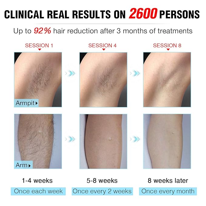 IMENE Laser Hair Removal Permanent - Painless IPL Technology for Women &amp Men - Bikini Legs Arms Armpits - Blue