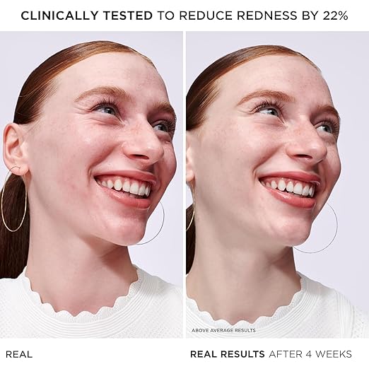 IT Cosmetics Bye Bye Redness Serum - Skin-Calming &amp Hydrating Face Serum - Instantly Neutralizes Facial Redness - 1% Colloidal Oatmeal Centella Peptide &amp Niacinamide ? All Skin Types - 1 fl
