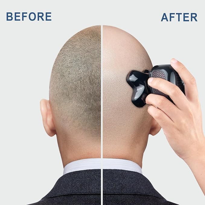 Telfun Magnetic Head Shavers for Bald Men Cordless 5-in-1 Electric Razor for Fast Shaving- IPX7 Waterproof Wet/Dry Mens Grooming Kit - Easy Use Palm Shaver for a Smooth Bald Shave