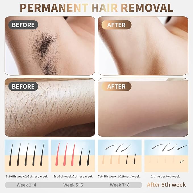 IPL Laser Hair Removal Device for Women &amp Men - at-Home Painless Ultra-Fast Flash Hair Remover 86% Hair Reduction in 4 Weeks High Energy &amp 5 Modes 8 Mins Full Body &amp Bikini Line &amp M