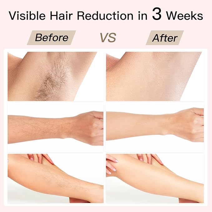Laser Hair Removal BoSidin IPL Hair Removal with Painless Ice-Cooling 2-in-1 Face SR Rejuvenation 6+1 Modes 6 Levels Hair Removal for Women Permanent Laser Hair Removal Kit with Shaver Goggles
