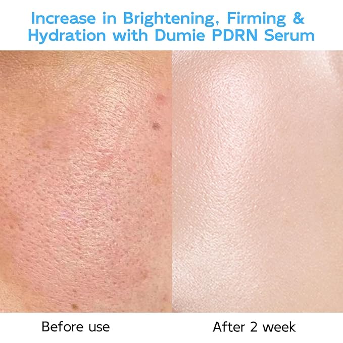 Salmon DNA PDRN Anti-Aging Serum 5000ppm Salmon Egg DNA Ampoule 2000ppm Collagen Glutathione Niacinamide &amp 6 Hyaluronic Acids Korean Skincare for Wrinkles &amp Radiance0.05 fl.oz x 30e