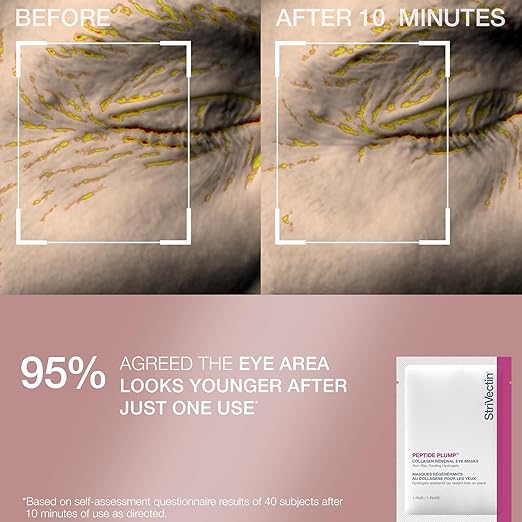 StriVectin Skin Care Holiday Gift Kits Beauty Routine Gift Sets - Brightening Smoothing &amp Hydrating Skin Care Stocking Stuffers