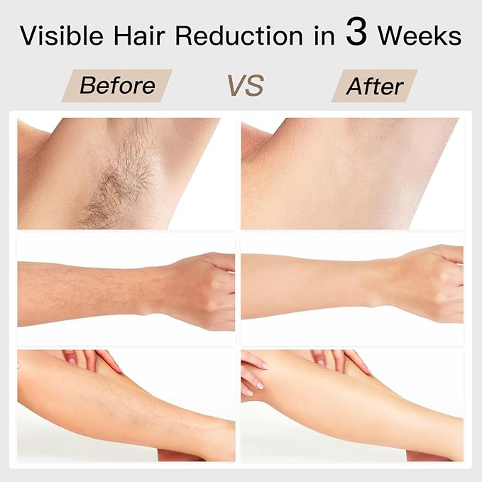 Laser Hair Removal BoSidin IPL Hair Removal with Painless Ice-Cooling 2-in-1 Face SR Rejuvenation 6+1 Modes 6 Levels Hair Removal for Women Permanent Laser Hair Removal Kit with Shaver Goggles