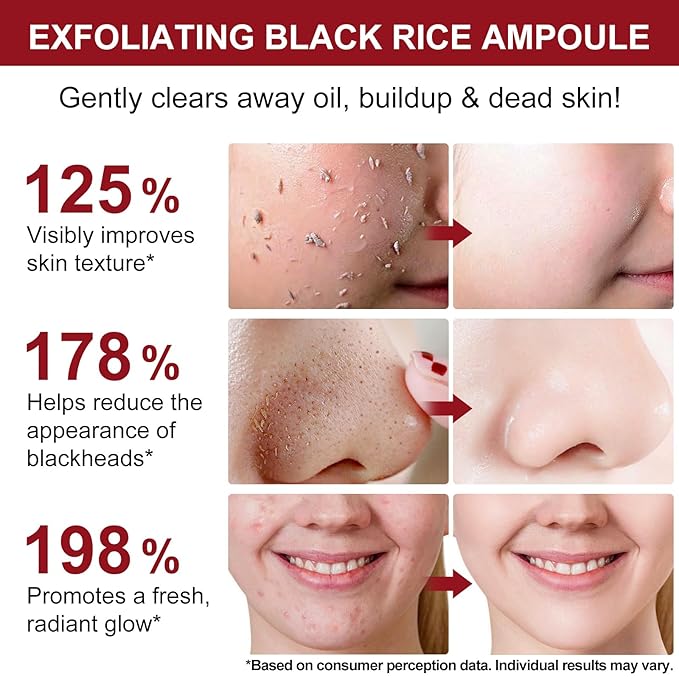 Black Rice Exfoliant+Rice Ampoule ExfoliantExfoliating Face Scrub &amp Body Scrub Dead Skin Cells Blackheads Remover For All Skin Types Korean Skin Care 100ml