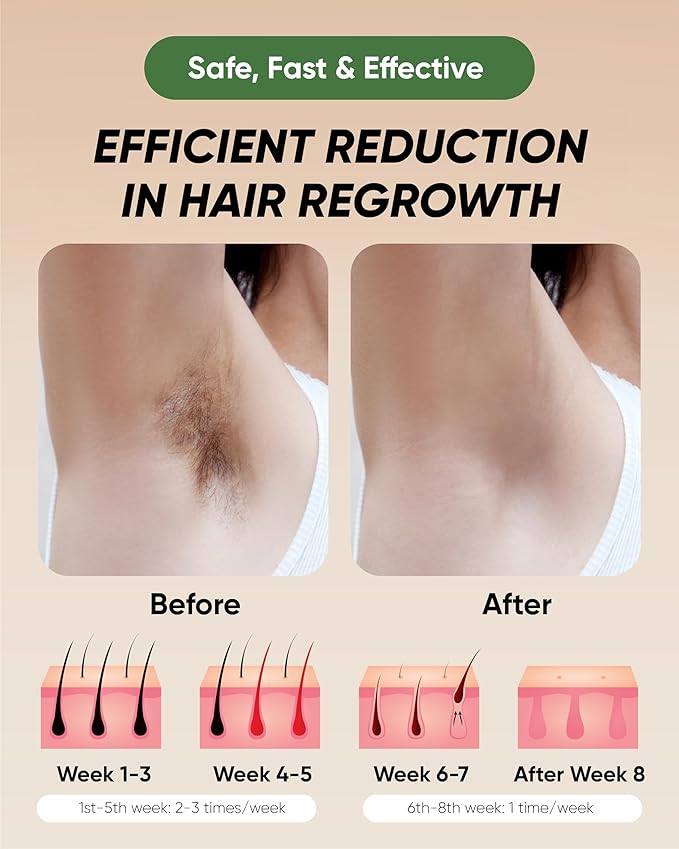 XSOUL At-Home IPL Hair Removal for Women and Men Permanent Hair Removal 999999 Flashes Painless Hair Remover on Armpits Back Legs Arms Face Bikini Line Corded