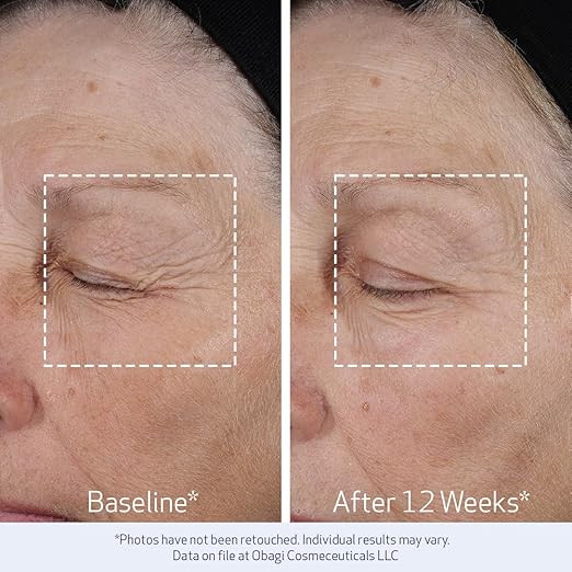 Obagi ELASTIderm Lift Up &amp Sculpt Facial Moisturizer ? Clinically Proven Anti-Aging Face Cream that Visibly Firms &amp Sculpts Facial Contours &amp Reduces Fine Lines &amp Wrinkles with Peptid