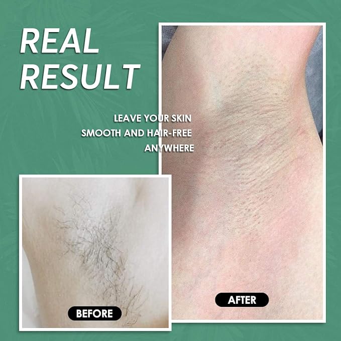Maxpearl Wax Beads for Hair Removal 2.5lb Hard Wax Beans Refill Bag for Brazilian Bikini Face Eyebrows Underarms Arms Chest Back Legs Coarse Body Hair Specific
