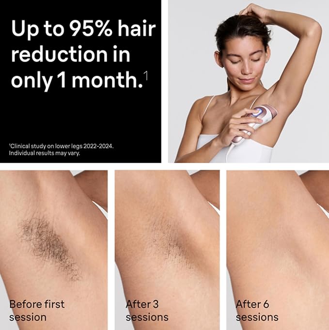 Braun Smart IPL Vogue?™s Best Hair Removal Device Skin i·Expert Pro 7: at Home Laser Hair Removal Permanent Visible Hair Reduction Gift Free App Vanity Case Venus Razor 4 Smart Heads IPL7387