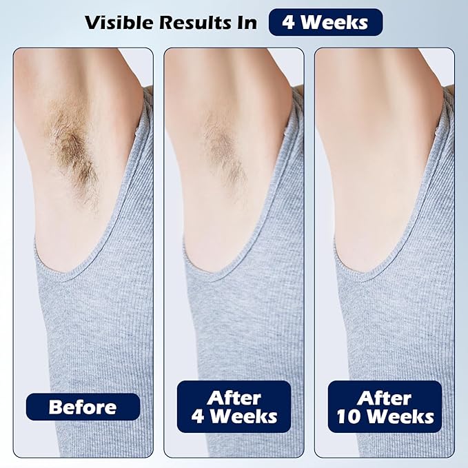 IPL Hair Removal Whole Body Hair Removal for Men and Women at Home Pain-Free &amp Long-Lasting for Body &amp Face Hair Removal Effective in 2 Weeks with Ultra-Fast 0.2S Light Emission(Green)