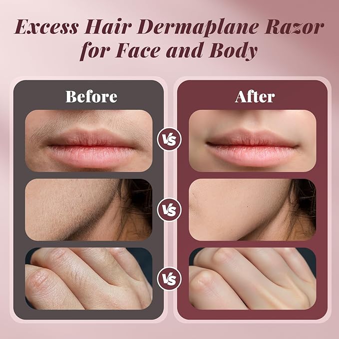 Dermaplane Razor for Women Face BNU Facial Hair Remover for Anti-Aging - Rechargeable - LED Light - Sonic Edges - 3 Speeds Ergonomic Handle Face Dermaplaning Tool 10 Weeks Pink