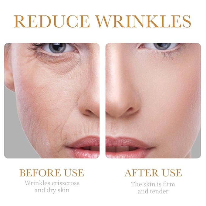 Collagen Skin Care Set 6Pcs Anti Aging Face Care Sets for Women Firming Skin Shrink Pores Smooth Wrinkles Hydrating Skin Care Set Include Serum Face Cream Eye Cream Toner Cleanser Facial Mask1