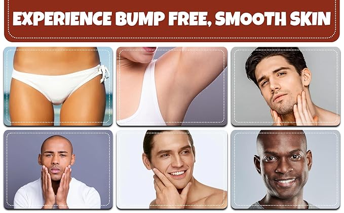 Razor Bumps and Ingrown Hair Treatment Folliculitis Treatment Back Of Head Bumps Remover - Roll On for Men &amp Women