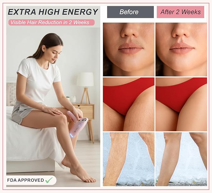 Latest Generation IPL Laser Hair Removal Device for Women. Long Lasting Visible Results in 2 Weeks. 45°F Cooling Painless Treatment Full Body Lazer Hair Removal with Precision Head &amp Ideal Gift B