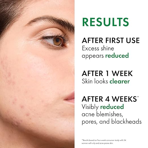 VICHY Normaderm Daily Acne Face Wash Salicylic Acid Face Cleanser for Oily &amp Acne Prone Skin Acne Cleanser that Clears Clogged Pores and Blackhead