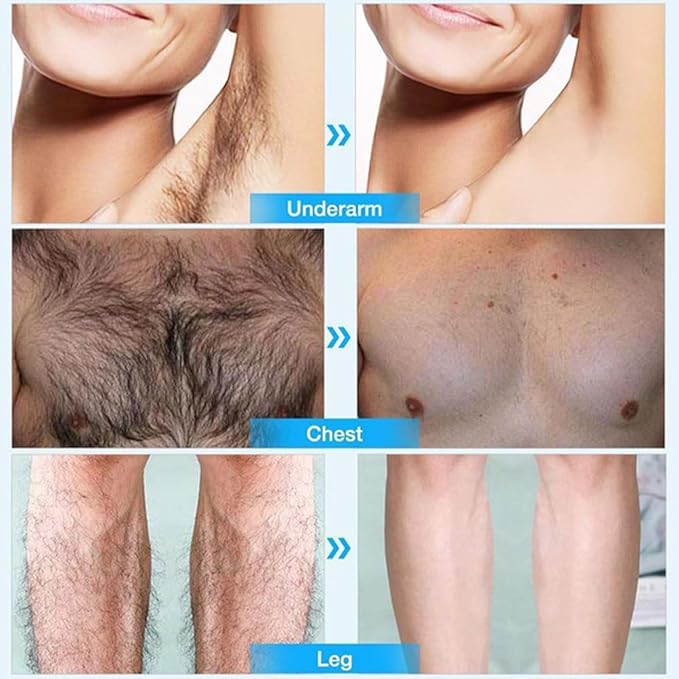 Hair Removal Cream for WomenSensitive Depilatory Cream for Bikini8 Minute Fast and Pain free Acting Depilatory for Legsand Underarms - Gentle Formula for All Skin Type10.59oz