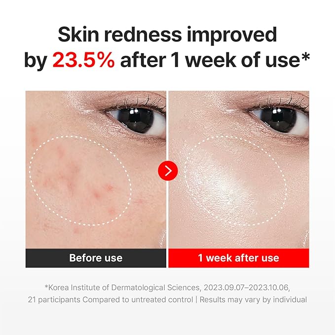 CENTELLIAN 24 Madeca Cream Time Reverse (1.69fl oz) - Advanced Fast-Absorbing &amp Nourishing Hydrates Firms &amp Reduces Wrinkles Low Irritation Korean Skin Care Centella Asiatica Collagen