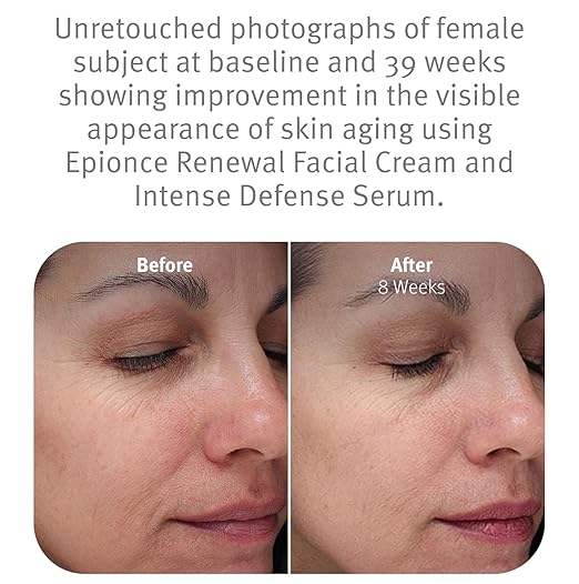 Epionce Renewal Facial Cream ? Hydrating Anti-Aging Moisturizer | For Dry Sensitive to Normal Skin | Fine Lines &amp Wrinkles | Dermatologist Skincare