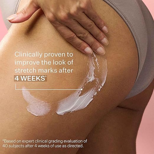 StriVectin SD Advanced Plus Intensive Moisturizer for Wrinkles and Stretchmarks For Face and Body Collagen Boosting with Peptides and Hyaluronic Acid