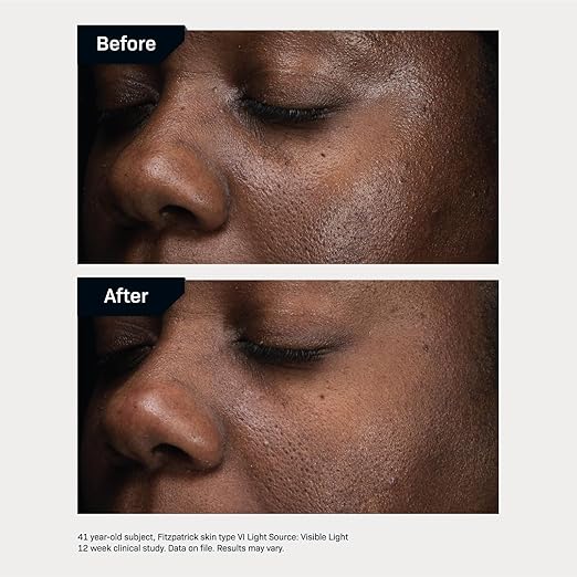 Revision Skincare D·E·J Daily Boosting Serum??Anti Aging Serum Reduces Wrinkles Supports Skin Firmness and Skin Elasticity