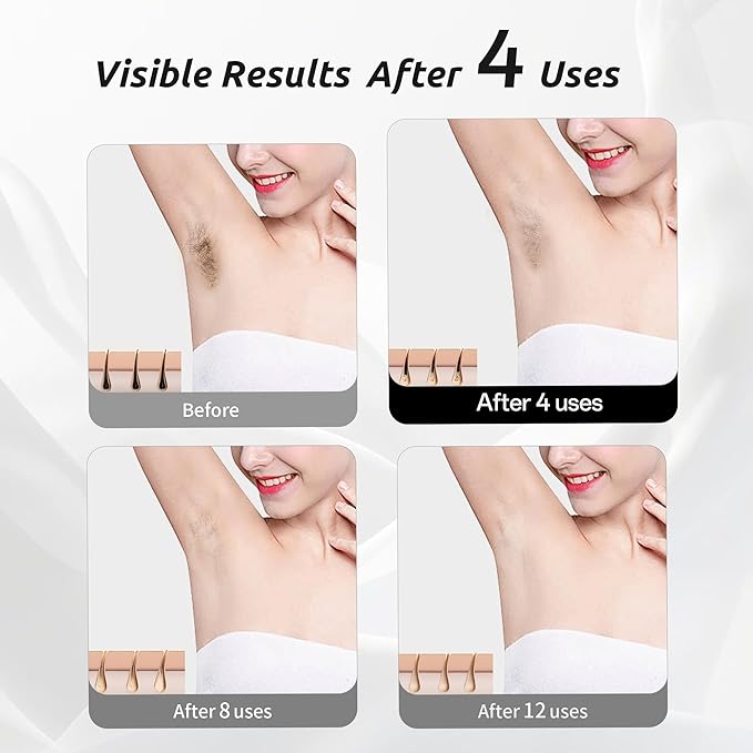 Laser Hair Removal Device for Women and Men IPL Painless Sapphire Laser Hair with 40°F Ice-Cooling System Safe for Body Treatment Long-Lasting Hair Removal from Home Face Legs Back Bikini Line