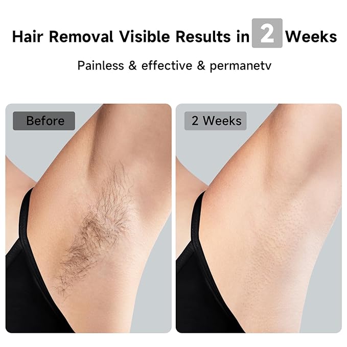 JOVS Laser Hair Removal 37°F Painless Hair Removal Device with Sapphire Ice-Cooling 3 in 1 Hair Removal &amp Skin Rejuvenation for Women and Men 8 Modes Skin Care for Whole Body Touch Screen Whi