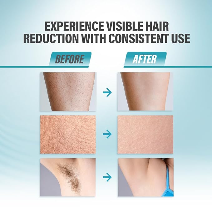 Herbishh IPL Laser Hair Removal Device Painless Cooling Technology- 400000 Flashes Hair Removal Machine with 5 Intensity Levels Skin Sensor &amp Dual Flash Modes- Manual &amp Auto For Face &amp
