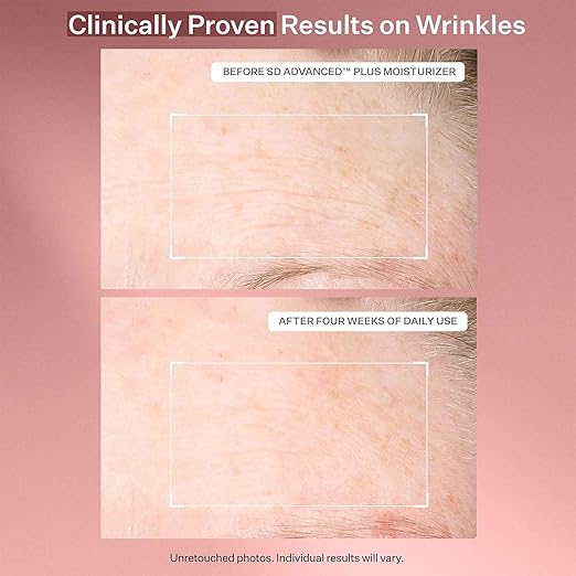 StriVectin SD Advanced Plus Intensive Moisturizer for Wrinkles and Stretchmarks For Face and Body Collagen Boosting with Peptides and Hyaluronic Acid