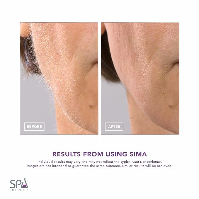 SPA SCIENCES - SIMA Patented Dermaplane Razor for Women Face ? Painless 2-in-1 Facial Exfoliation &amp Peach Fuzz Hair Removal ? Anti-Aging ? 3 Speeds ? Rechargeable ? 7 Weeks Treatment
