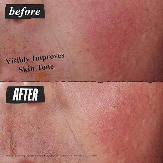 Kiehl's Ultra Facial Advanced Repair Barrier Cream Intensive Treatment Relieves Dry + Sensitive Skin Rapidly Reduces Redness and Soothes Fast-Absorbing Breathable Formula Paraben-Free - 1.7 fl oz