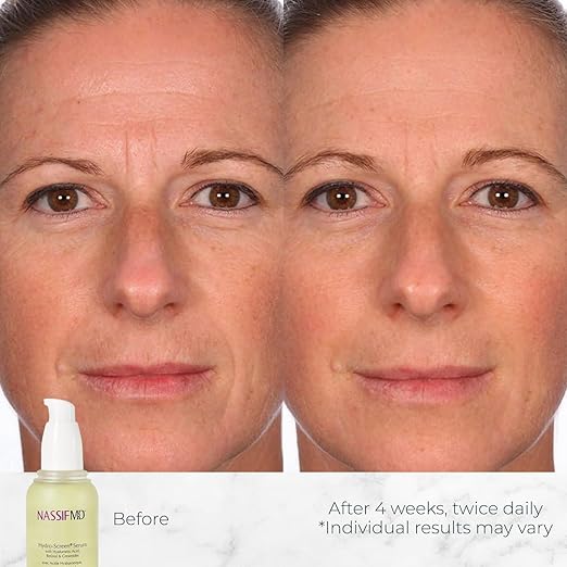 NassifMD Hydro-Screen Hydration Serum | Surgeon-Created Hyaluronic Acid Ceramides &amp Retinol Formula for Plumping Firming &amp Reducing Fine Lines