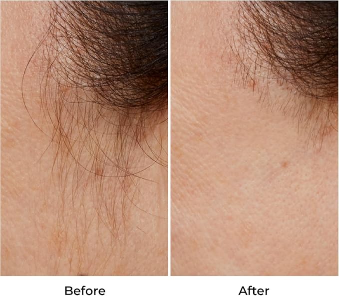 LUMINESS Silk &amp Smooth Skin Care Set: Flawless Facial Hair Removal &amp Face Moisturizer for Women - Painless Facial Razor for Lips Chin Peach Fuzz - 2 Electric Shavers &amp Hydrating Cream wi