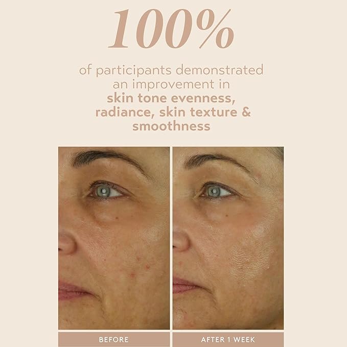 SHANI DARDEN SKIN CARE Retinol Reform with 1% Encapsulated Retinol Serum for Face &amp Neck Gentle Slow-Release Retinol Face Serum with Tripeptide for Wrinkles Fine Lines &amp Uneven Tone 0.3 fl