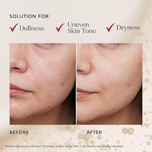 SK-II Facial Masks - Brightening Face Mask Sheets to Help Improve Tone Texture &amp Radiance - Anti-Aging Treatment for Replenished Moisture &amp Visibly Healthier Skin