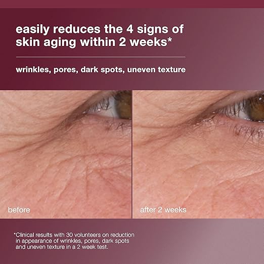 Dermalogica Dynamic Skin Retinol Facial Serum with Multi-Retinoid Complex Skin Retexturizing and Improving Skin Health