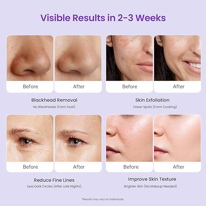 UNOISETION Diamond Microdermabrasion Machine Professional 3 in 1 Dermabrasion Facial Peeling Skin Care Device for Salon Personal Home Use