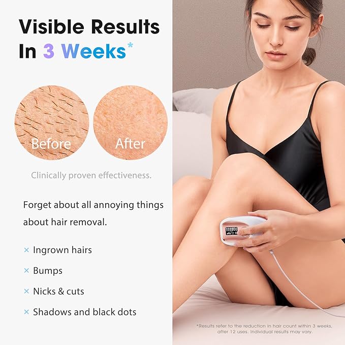 IPL Laser Hair Removal Device for Women &amp Men - Home 45°F Ice-Cooling Contact for Painless &amp Long-Lasting Results 86% Hair Reduction in 3 Weeks for Full Body &amp Bikini Line Rose Gold
