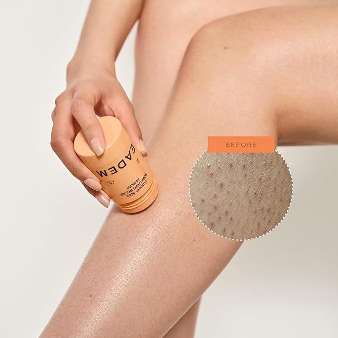 EADEM Smooth Slate Ingrown Hair Roller Serum Targets Bumps Trapped Hairs Faded Topicals for Scarring and Dark Spots AHAs and Tyrosinase Slows Ingrown Hair Regrowth